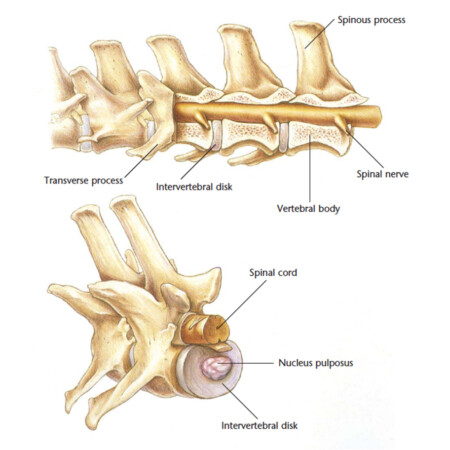 Hemilaminectomy Dog